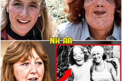 Before She Died, Rocky Dennis’s Mom FINALLY Broke Silence About Rocky Dennis And It’s Not Good